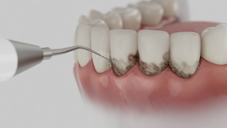 Trusted Dental Crowns And Bridges service in Springfield, TN - Dentist Open Now